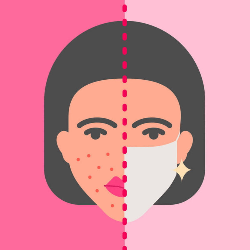 „MASKNE” – nowy problem skórny i wyzwanie dla kosmetologów.